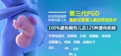 抗精子抗体可以做试管吗